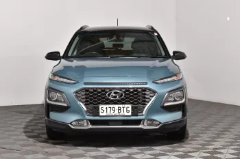 2017 Used Hyundai Kona